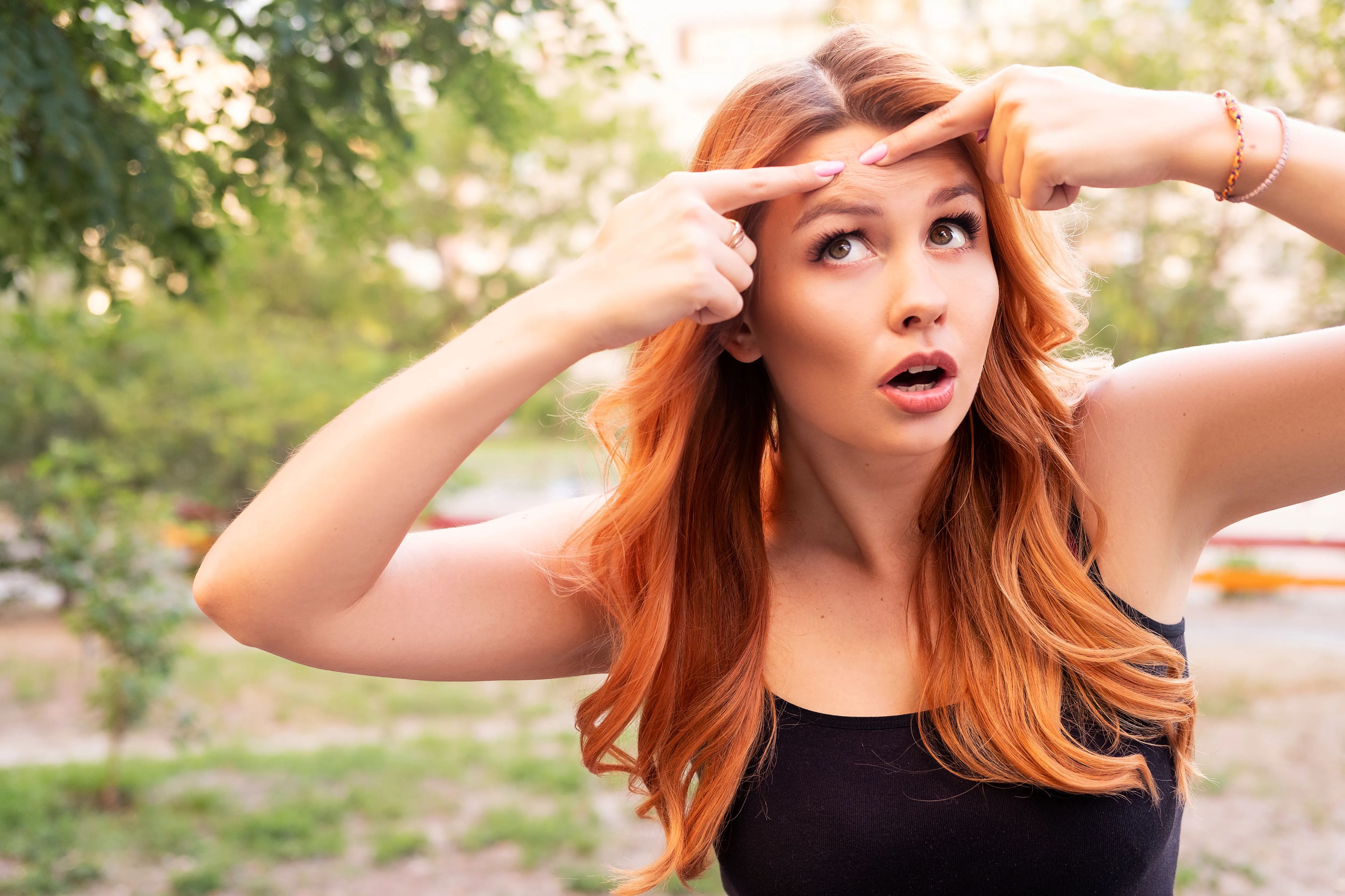 Young redheaded woman outdoors pointing to a pimple on her forehead. 