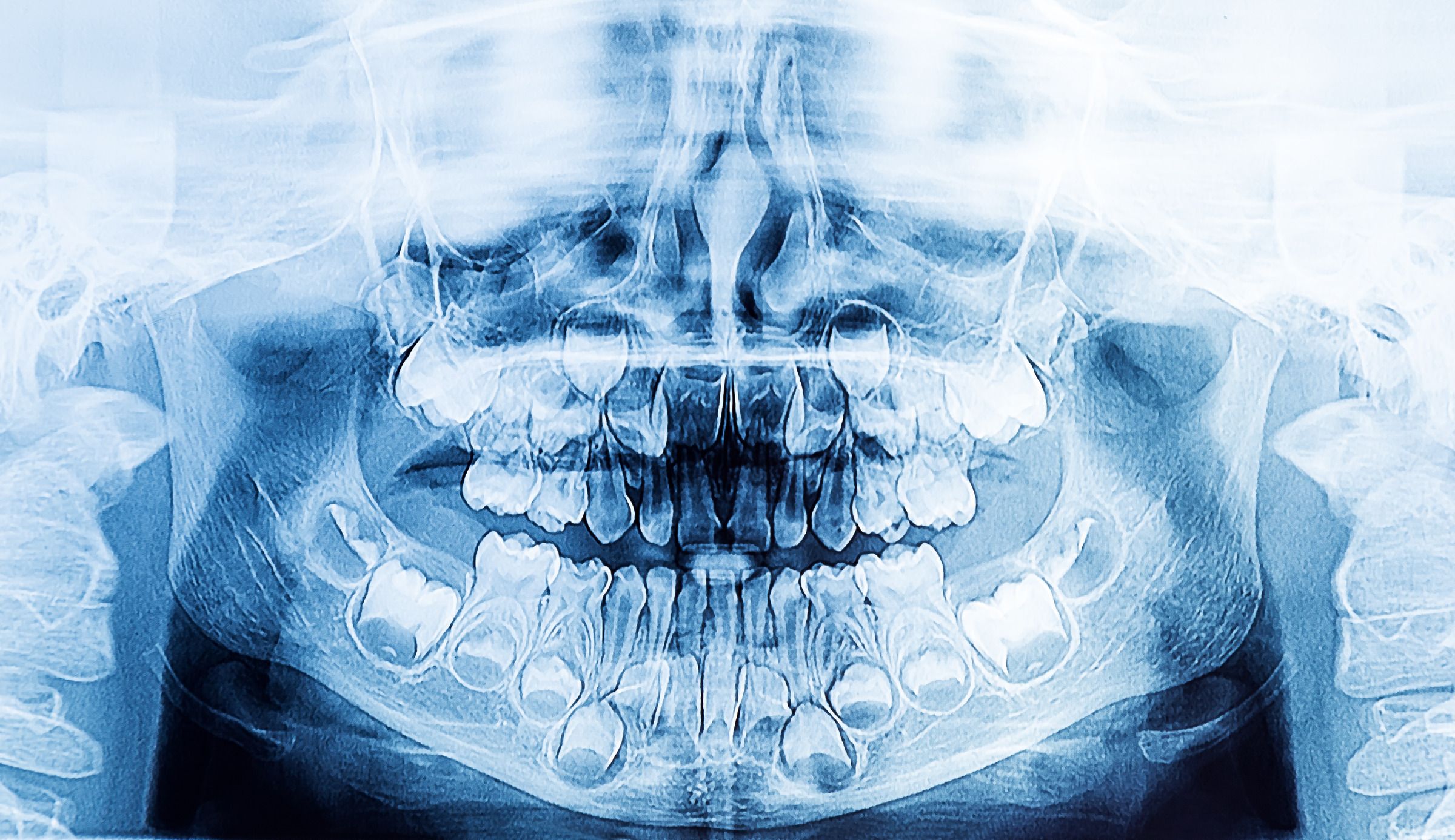 Image result for ravindranath teeth