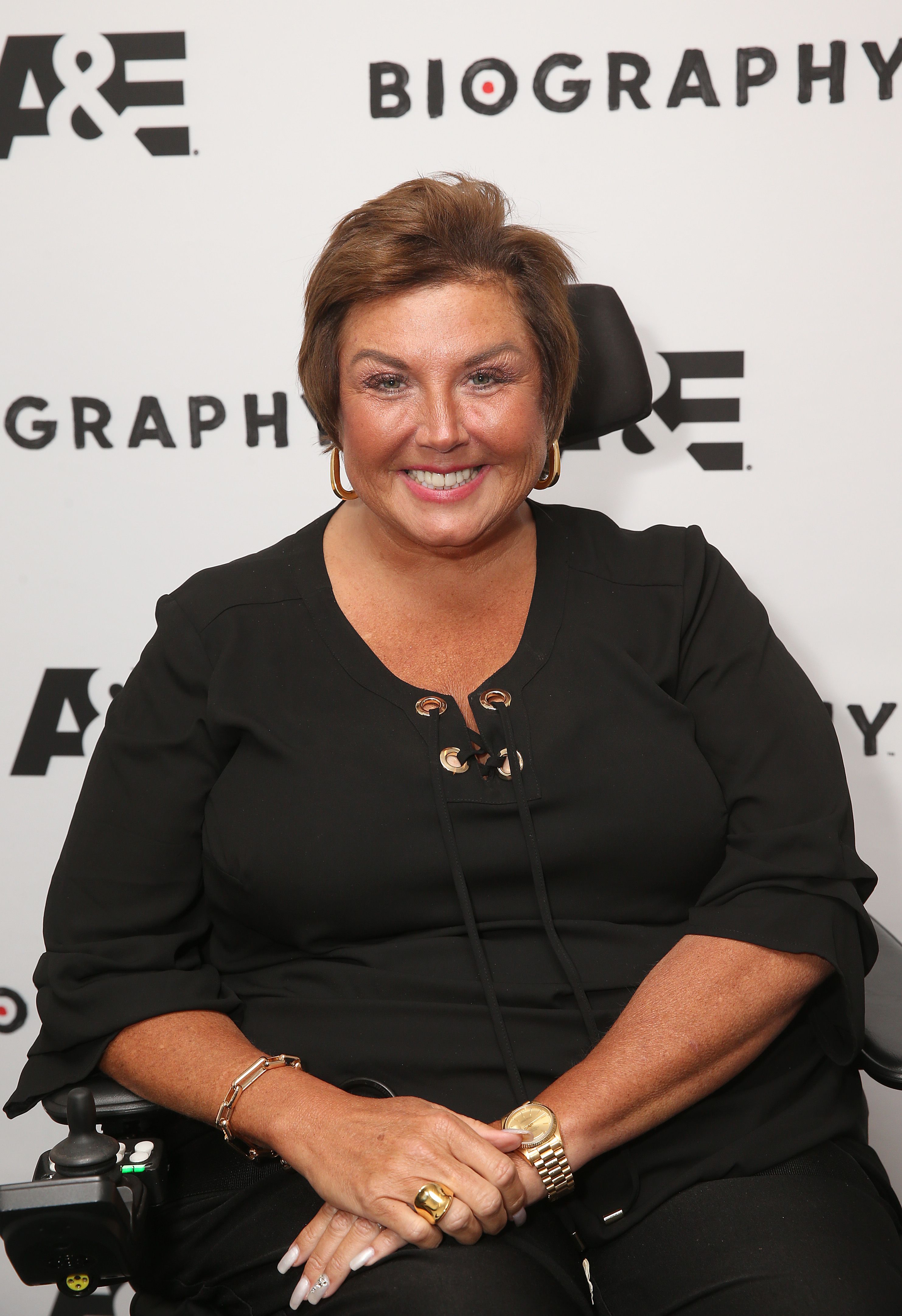 Abby Lee Miller of 'Dance Moms' Had Plastic Surgery While Awake And