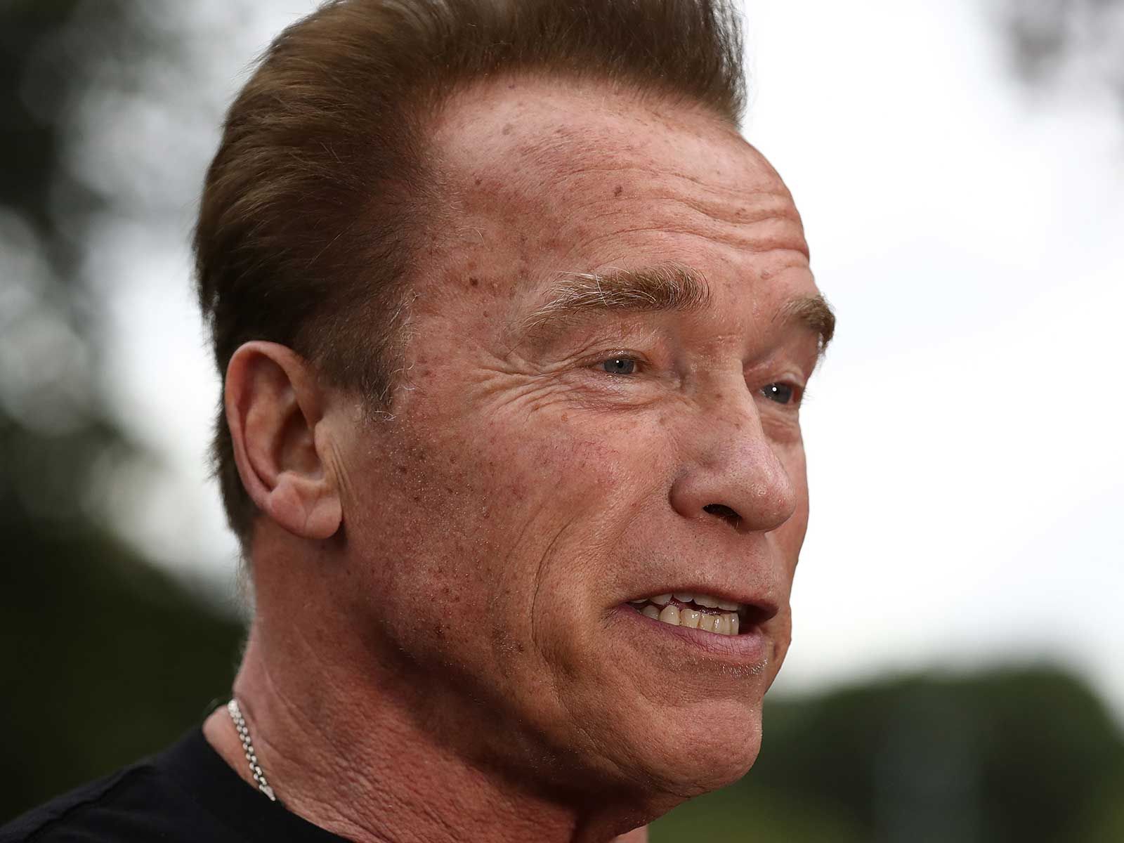 Arnold Schwarzenegger Wakes Up After Heart Surgery And Says I M Back
