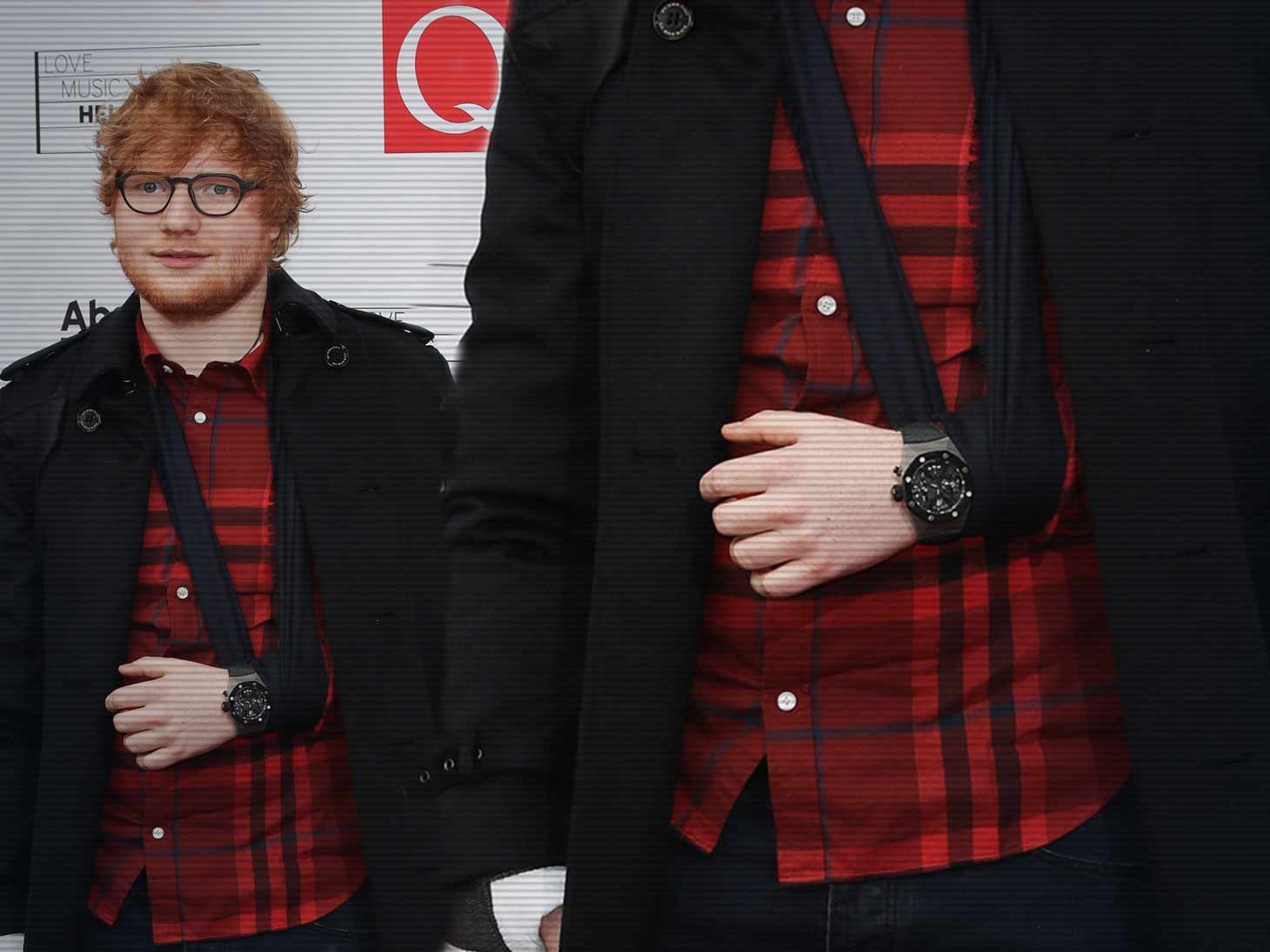Ed Sheeran’s Broken Arm at the Center of New Lawsuit