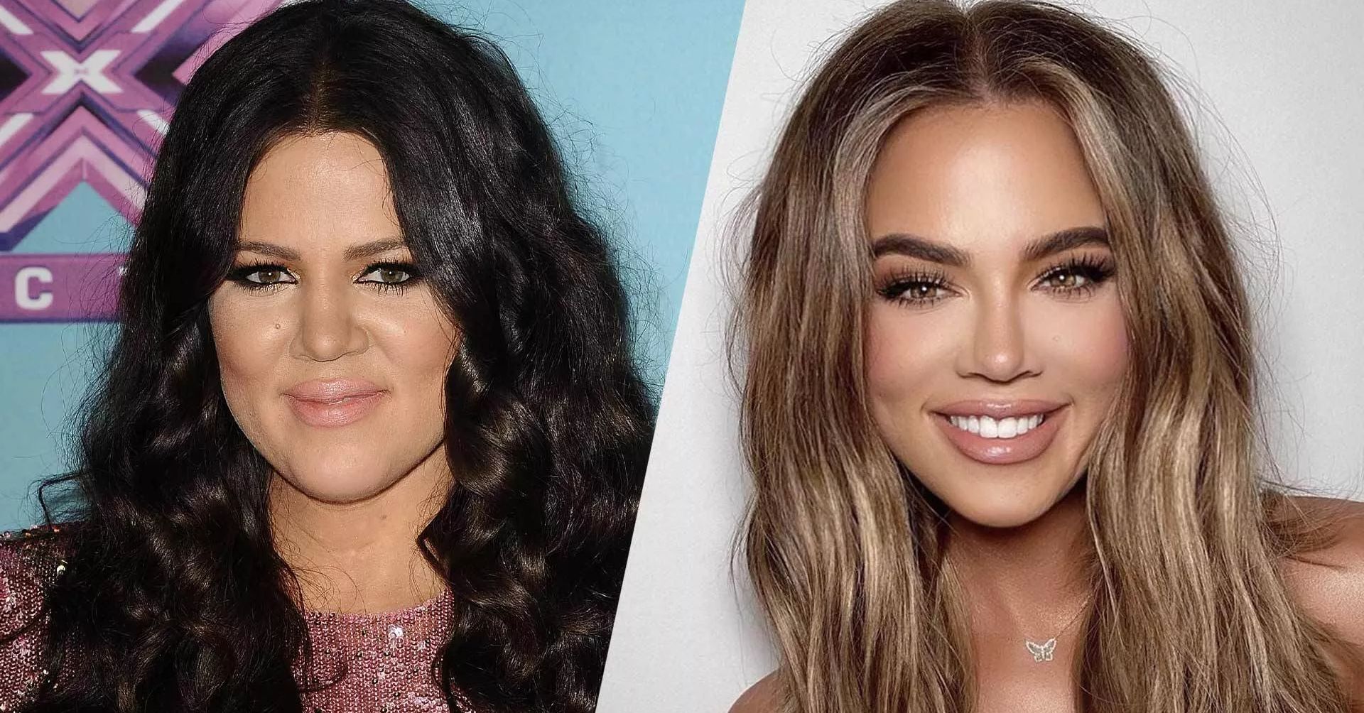 Khloe Kardashian Plastic Surgeons Weigh In On Reality Stars Shocking