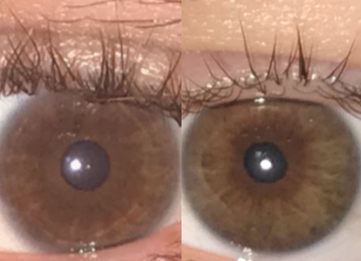 It Turns Out This Viral Pic Doesn't Actually Show What Astigmatism